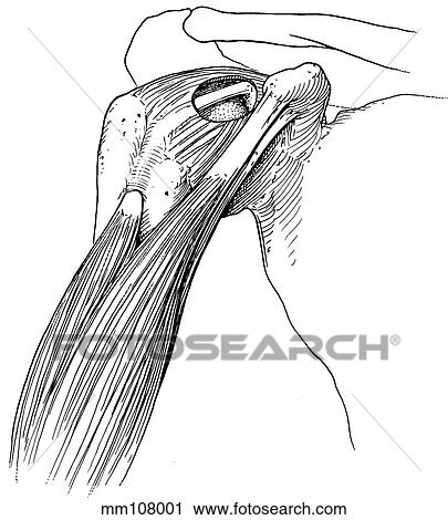 Clip Art - Biceps tendon. Fotosearch