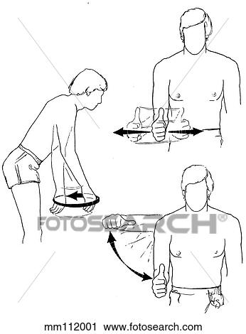 Clip Art - Dislocation, rehabilitation, shoulder. Fotosearch