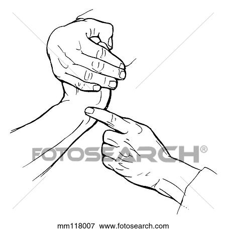 Stock Illustration - Extensor carpi ulnaris palpation. Fotosearch