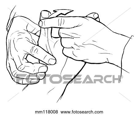 Extensor pollicis brevis View Large Illustration Stock Illustration - Extensor pollicis brevis. Fotosearch