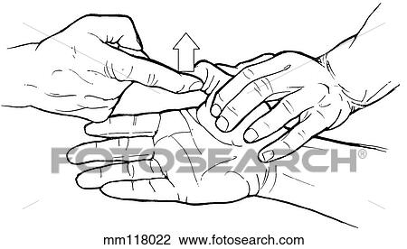 Drawing - Flexor pollicis longus. Fotosearch