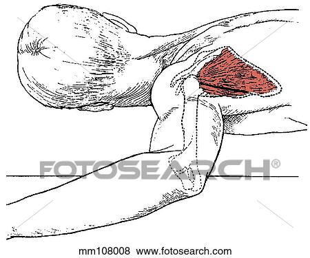 Infraspinatus muscle View Large Illustration Stock Illustration - Infraspinatus muscle. Fotosearch