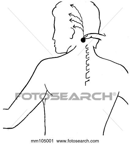 Clip Art - Occipital nerve. Fotosearch