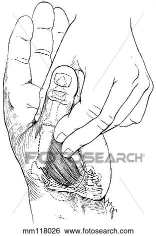Stock Illustration - Opponens pollicis. Fotosearch