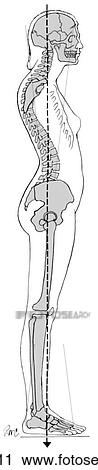 Posture, kyphosis-lordosis View Large Illustration Clip Art - Posture, kyphosis-lordosis. Fotosearch