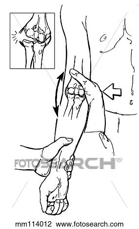 Drawing - Radial collateral ligament of elbow. Fotosearch