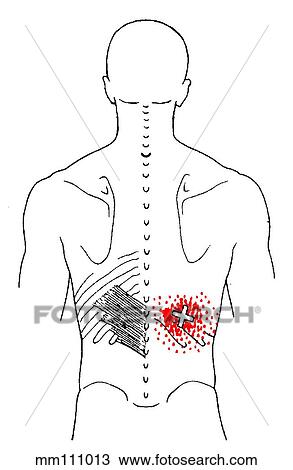 Drawing - Serratus posterior inf. m., trigger points. Fotosearch