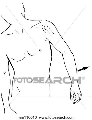 Shoulder abduction View Large Illustration Clipart - Shoulder abduction. Fotosearch