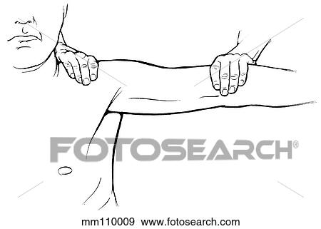 Shoulder abduction View Large Illustration Stock Illustration - Shoulder abduction. Fotosearch