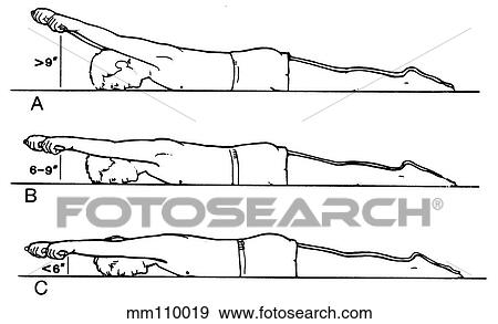 Shoulder girdle View Large Illustration Stock Illustration - Shoulder girdle. Fotosearch
