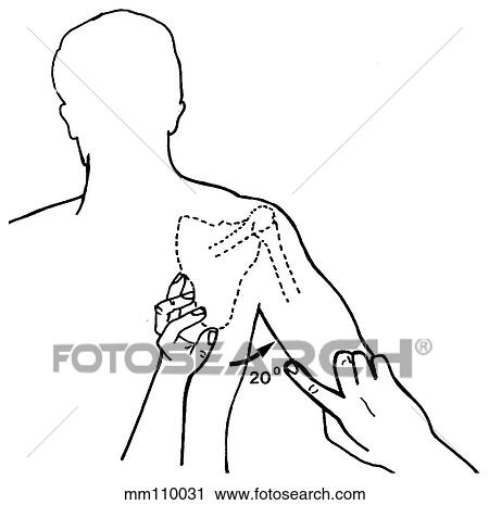 Clip Art - Shoulder, range of abduction. Fotosearch