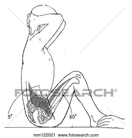 Sit-up, curled-trunk View Large Illustration Clip Art - Sit-up, curled-trunk. Fotosearch