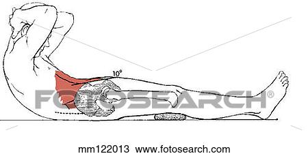 Sit-up, curled-trunk View Large Illustration Drawing - Sit-up, curled-trunk. Fotosearch