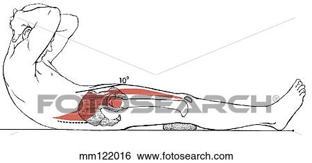 Sit-up, curled-trunk View Large Illustration Stock Illustration - Sit-up, curled-trunk. Fotosearch