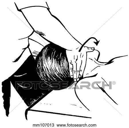 Technique 1, cervical spine View Large Illustration Drawing - Technique 1, cervical spine. Fotosearch