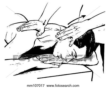 Stock Illustration - Technique III, cervicothoracic junction. Fotosearch