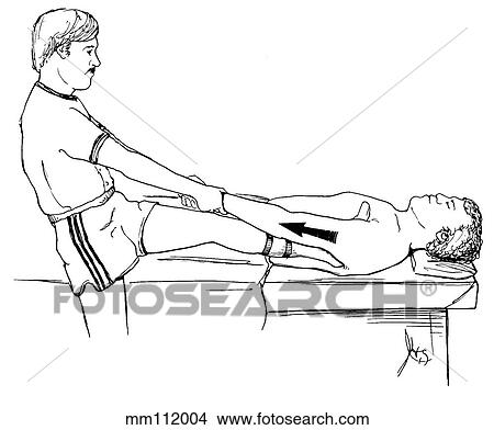 Traction reduction, shoulder View Large Illustration Stock Illustration - Traction reduction, shoulder. Fotosearch