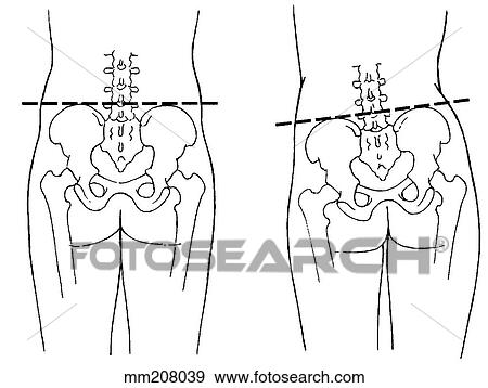 骨盤 動き イラスト Mm8039 Fotosearch