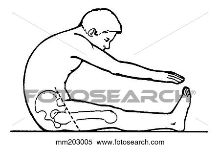 Back flexion, excessive View Large Illustration Stock Illustration - Back flexion, excessive. Fotosearch
