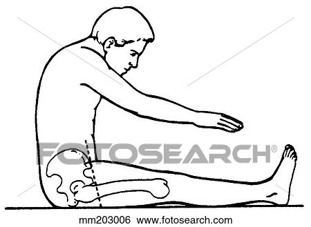 Back flexion, excessive View Large Illustration Stock Illustration - Back flexion, excessive. Fotosearch
