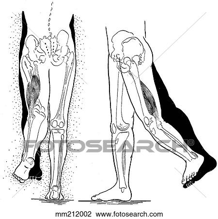 Biceps femoris, shortened View Large Illustration Drawing - Biceps femoris, shortened. Fotosearch