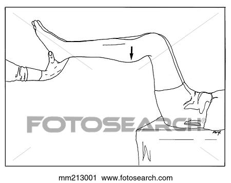 Clip Art - Drop back test. Fotosearch