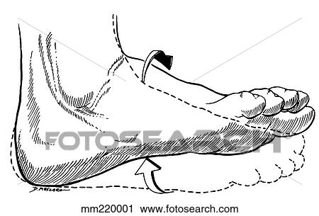 Exercise, ankle sprain View Large Illustration Clip Art - Exercise, ankle sprain. Fotosearch