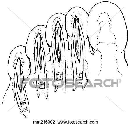 Flexor digitorum brevis View Large Illustration Drawing - Flexor digitorum brevis. Fotosearch
