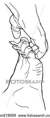 Hallux interphalangeal joint flexion View Large Illustration Stock Illustration - Hallux interphalangeal joint flexion. Fotosearch