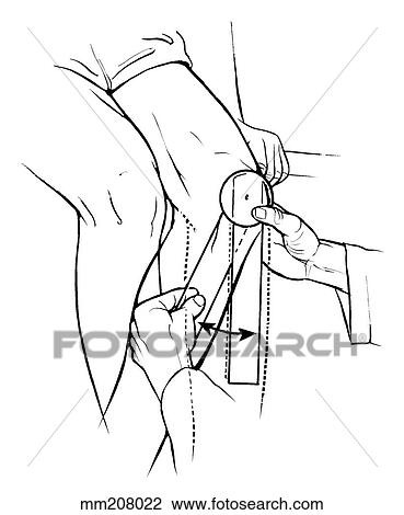 Drawing - Hip external rotation. Fotosearch
