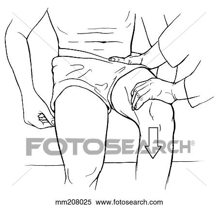 Hip flexion View Large Illustration Stock Illustration - Hip flexion. Fotosearch