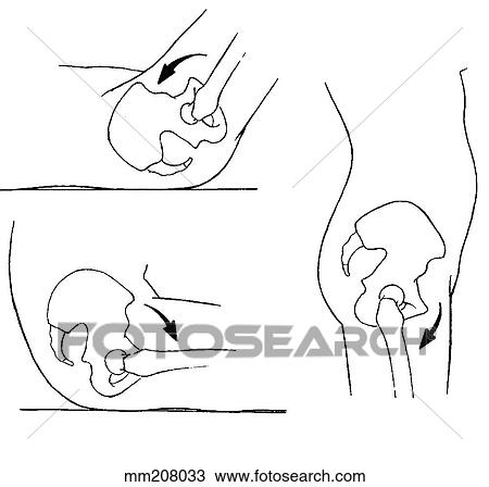 Hip joint flexion View Large Illustration Drawing - Hip joint flexion. Fotosearch