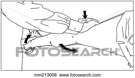 Lateral pivot shift test View Large Illustration Stock Illustration - Lateral pivot shift test. Fotosearch