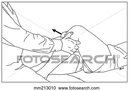 Ligament, anterior cruciate, test View Large Illustration Clipart - Ligament, anterior cruciate, test. Fotosearch