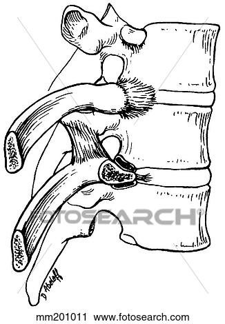 Clip Art - Ligaments, spinal. Fotosearch