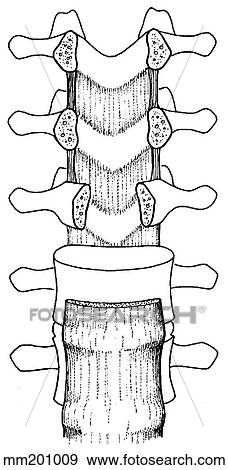Stock Illustration - Ligaments, spinal. Fotosearch