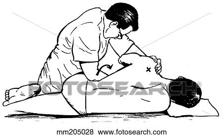Manipulation technique 7, lumbar spine View Large Illustration Stock Illustration - Manipulation technique 7, lumbar spine. Fotosearch
