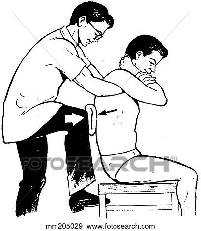 Stock Illustration - Manipulation technique IV, thoracic spine. Fotosearch
