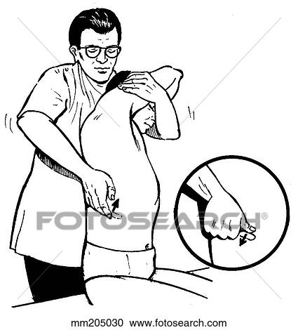 Manipulation technique V, false ribs View Large Illustration Clipart - Manipulation technique V, false ribs. Fotosearch
