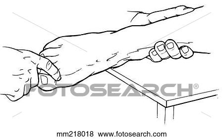 Metatarsophalangeal joint extension of the hallux View Large Illustration Stock Illustration - Metatarsophalangeal joint extension of the hallux. Fotosearch