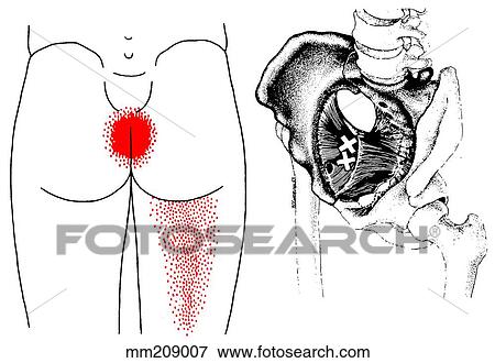 Stock Illustration - Obturator internus m., trigger points. Fotosearch