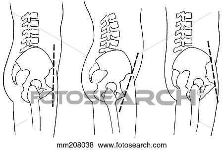 Stock Illustration - Pelvic movement. Fotosearch