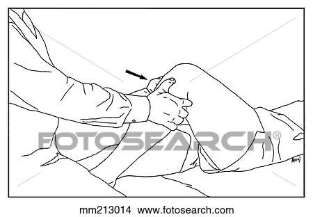Posterior drawer test View Large Illustration Stock Illustration - Posterior drawer test. Fotosearch