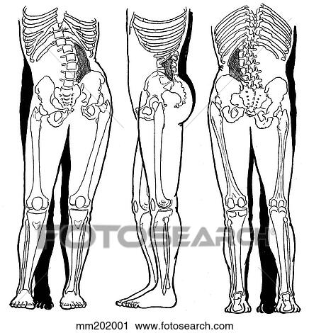 Clip Art - Quadratus lumborum, shortened. Fotosearch