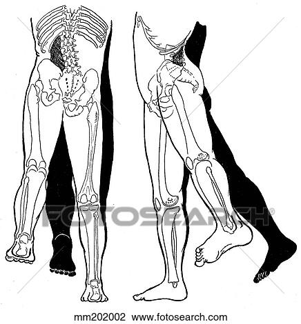Quadratus lumborum, shortened View Large Illustration Drawing - Quadratus lumborum, shortened. Fotosearch
