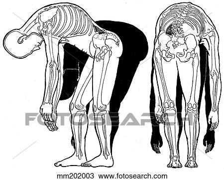 Drawing - Quadratus lumborum, shortened. Fotosearch