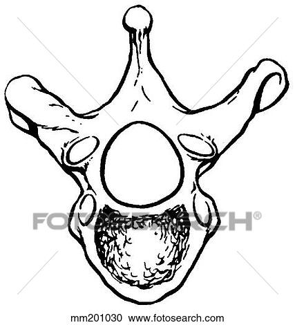 Thoracic vertebra View Large Illustration Clipart - Thoracic vertebra. Fotosearch