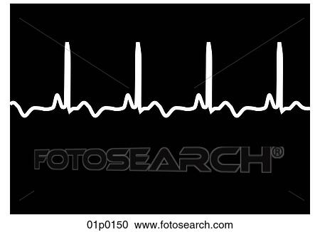 Clipart - medical monitor. Fotosearch