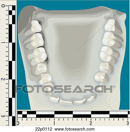 Clipart - dental id. Fotosearch