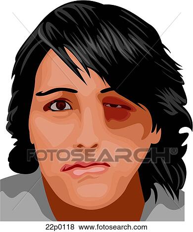 domestic violence View Large Clip Art Graphic Clip Art - domestic violence. Fotosearch